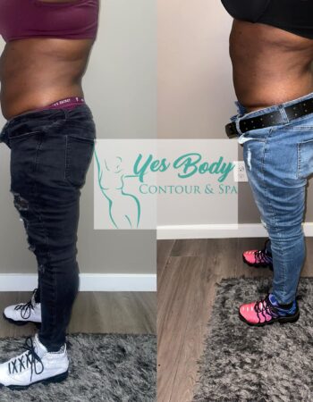 Yes Body Contour & Spa